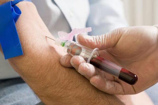 Testiranje krvi – odkriva že zelo majhne  tumorje, metastaze in začetne rakave celice